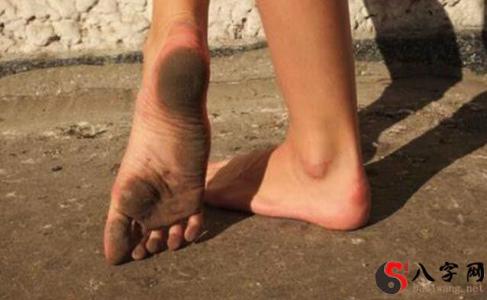 It's not a good idea to walk when you see feces all over the place.